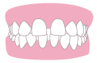 espaciado dental