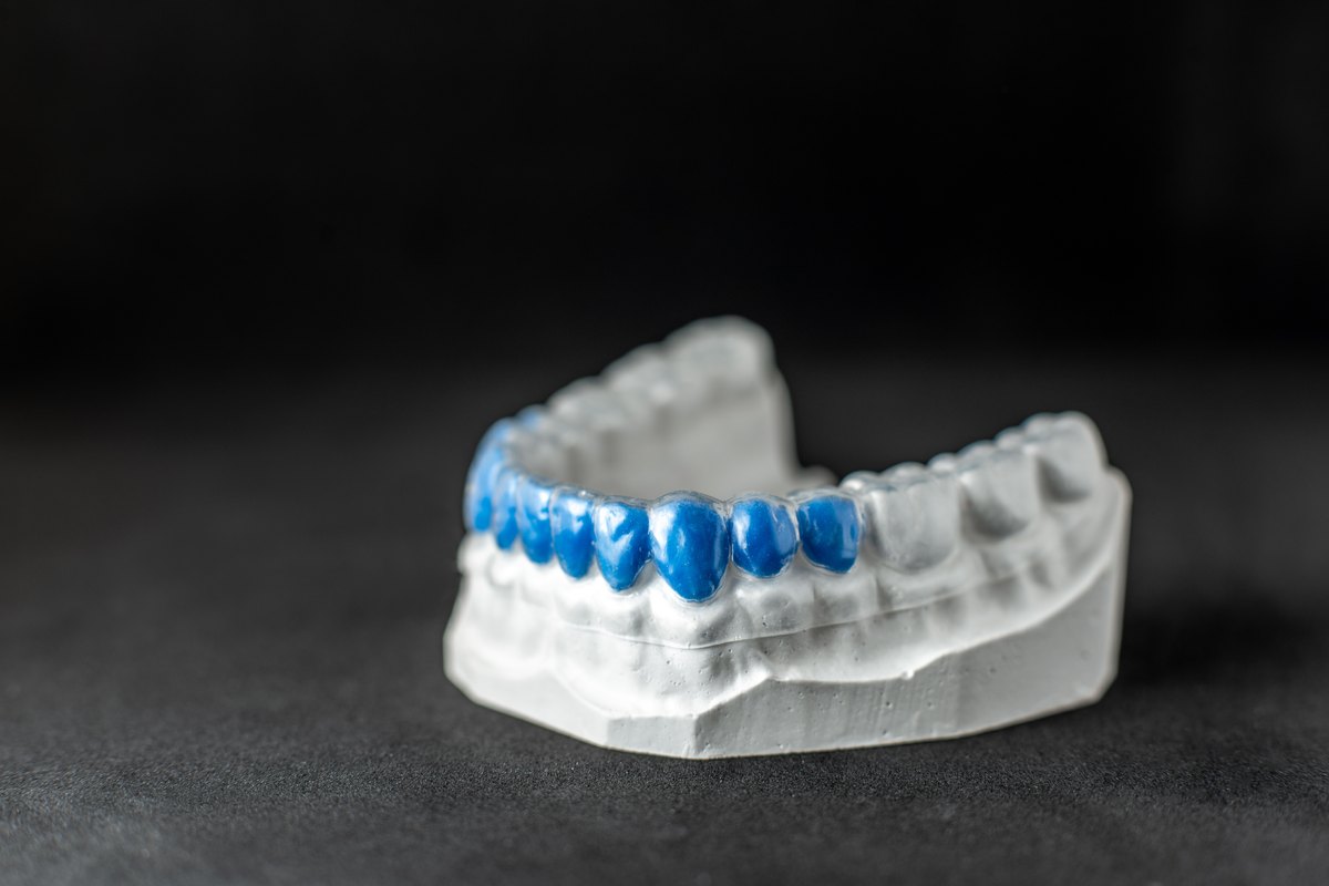 Alineadores invisibles o brackets: alineador transparente colocado sobre un modelo dental