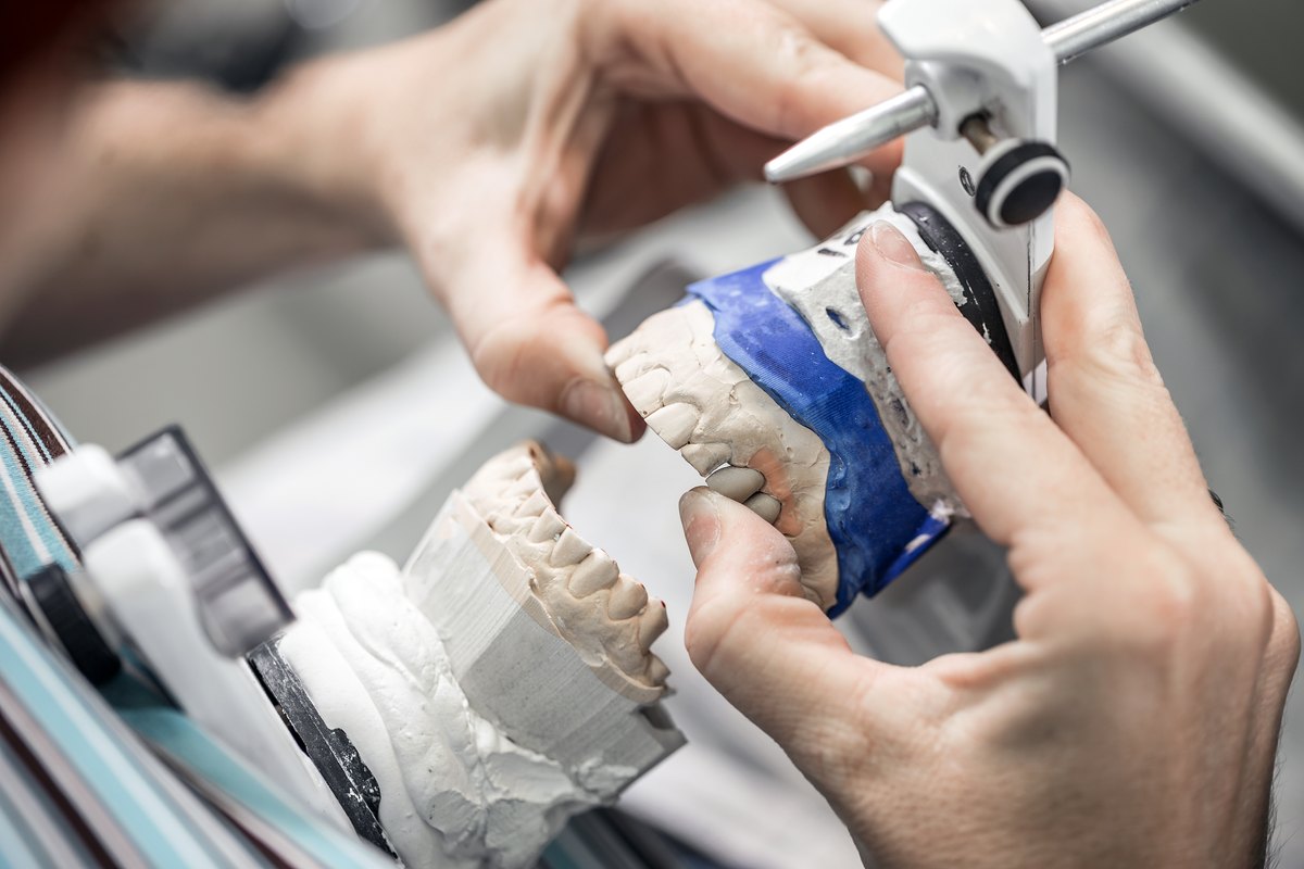 Cómo se fabrican los brackets linguales: técnico dental trabajando en el laboratorio