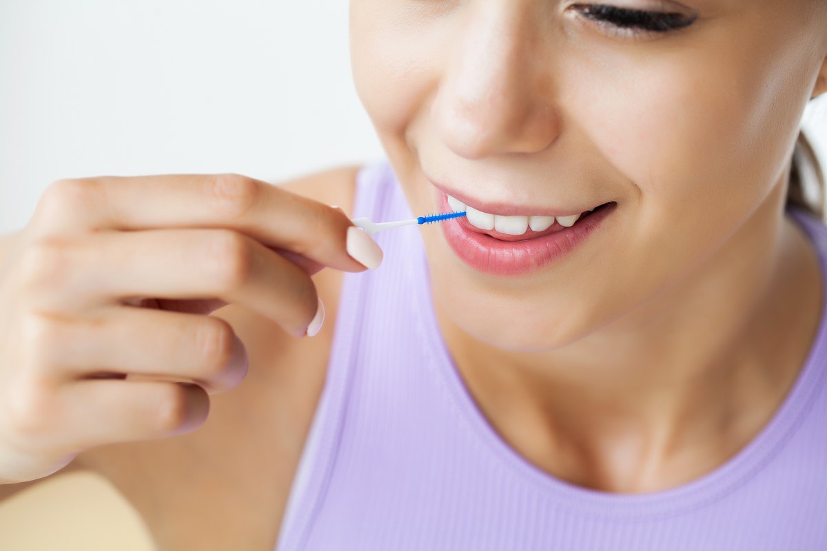 Limpiar los brackets: una mujer usa cepillos interdentales entre los dientes