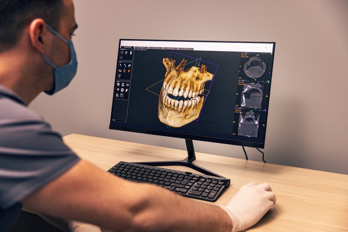 Ortodoncia lingual con brackets por dentro: el dentista trabaja ante el monitor
