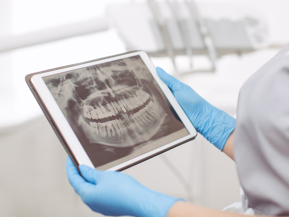 Qué debe incluir un presupuesto de ortodoncia: radiografía panorámica en una tableta