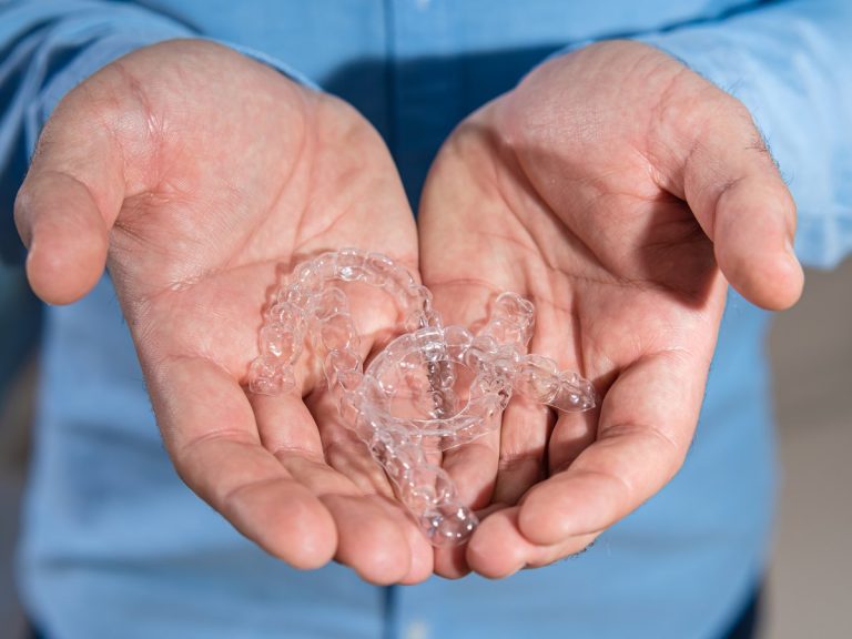 Dos férulas transparentes de retención en las manos del ortodoncista