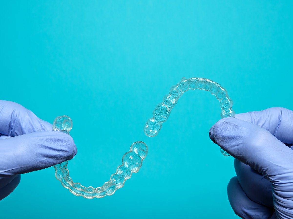Contención después de ortodoncia: manos enguantadas que sostienen retenedores dentales transparentes