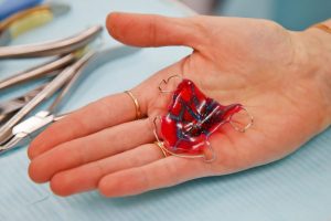 Mano abierta que sostiene un aparato removible de ortodoncia para el paladar, de resina roja y azul con ganchos de alambre, junto a instrumental dental