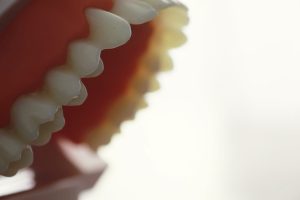 Primer plano lateral de los dientes de un modelo dental, con la encía de color rojo, sobre fondo blanco