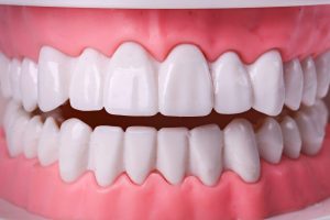 Modelo dental de primer plano con encías rosas en el que los dientes de delante de arriba y de abajo quedan separados, sin llegar a tocarse