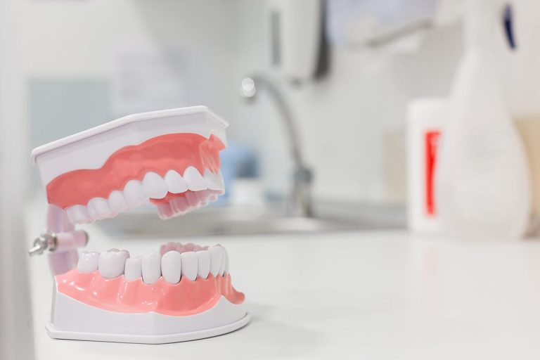 Modelo dental de las dos arcadas con la boca abierta sobre una encimera blanca de consulta, con un grifo al fondo
