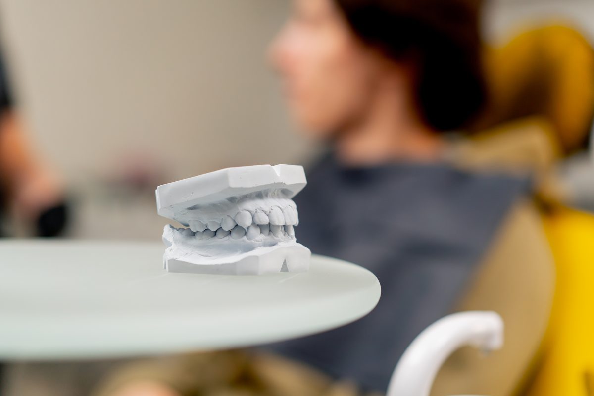 Modelo de escayola de los dientes de arriba y de abajo encajados, sobre una mesa de la consulta, con una persona desenfocada en el sillón dental al fondo