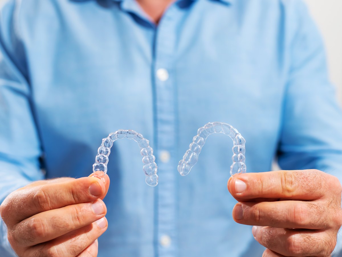 Tratamiento con alineadores transparentes: el médico dentista sostiene alineadores transparentes en sus manos